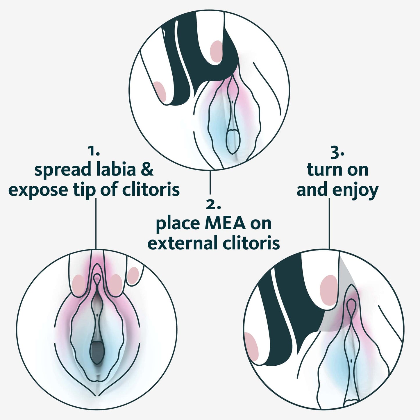 MEA